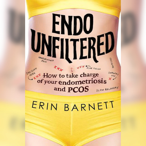<strong>Endo Unfiltered</strong> by Erin Barnett